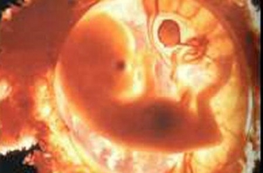 Я сделала аборт. Как жить дальше?