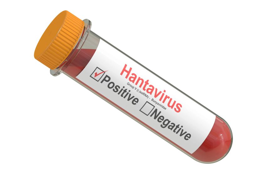 Хантавирус после COVID-19