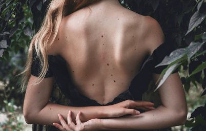 Родинки на теле