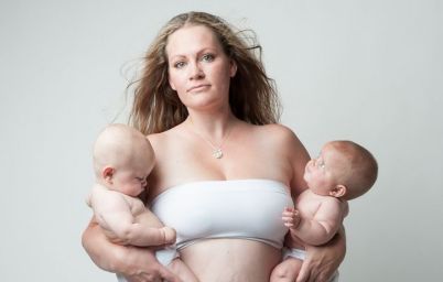 После родов: 9 вопросов пластическому хирургу