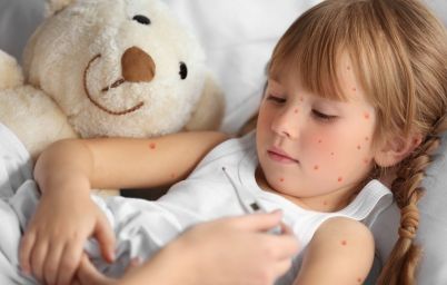 у девочки ветрянка