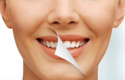 Отбеливание зубов