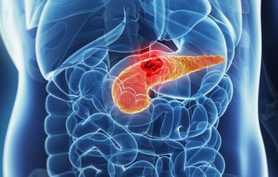 ОНКОсвідомость