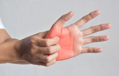 Ожог кипятком или паром