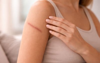 Печуть шви після операції