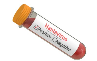 Хантавирус после COVID-19