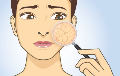 5 ошибок ухода за сухой кожей: советы дерматолога