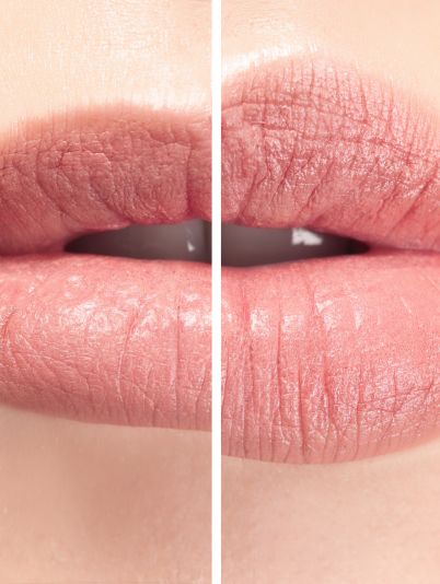 увеличить губы дома