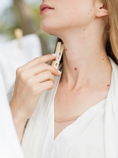 Как ухаживать за родинками