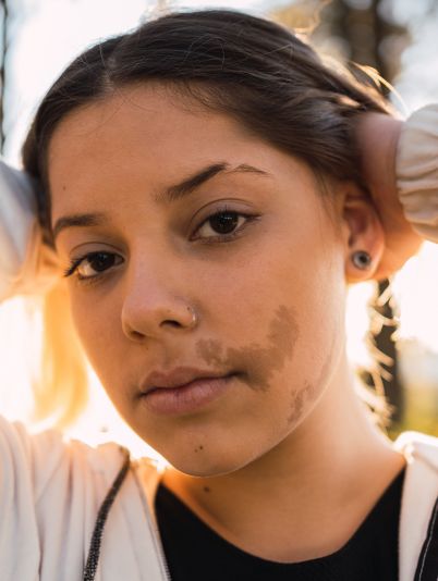 Пигментация