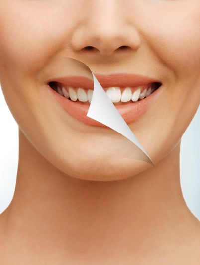 Отбеливание зубов