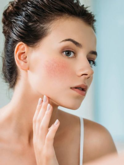 Догляд за чутливою шкірою