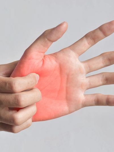 Ожог кипятком или паром