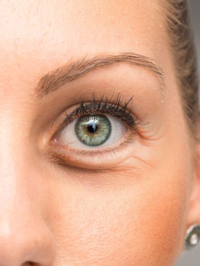 Как убрать круги под глазами