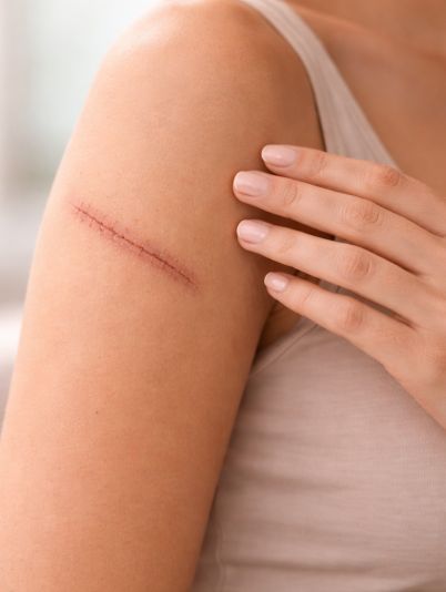 Печуть шви після операції