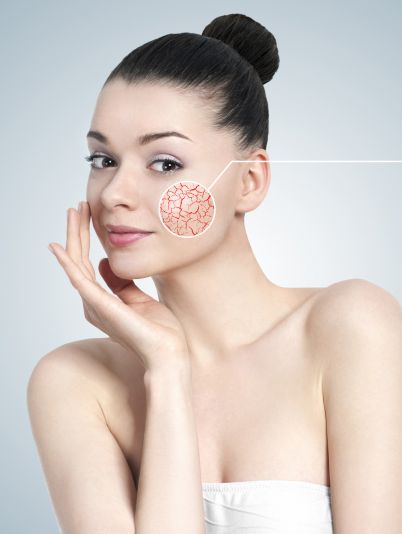 здоровье сосудов, профилактика для сосудов, профилактика для здоровых сосудов