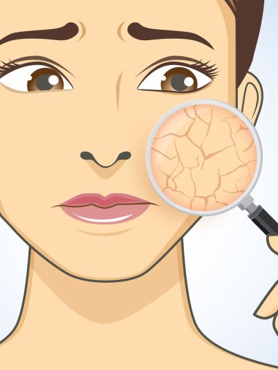 5 ошибок ухода за сухой кожей: советы дерматолога