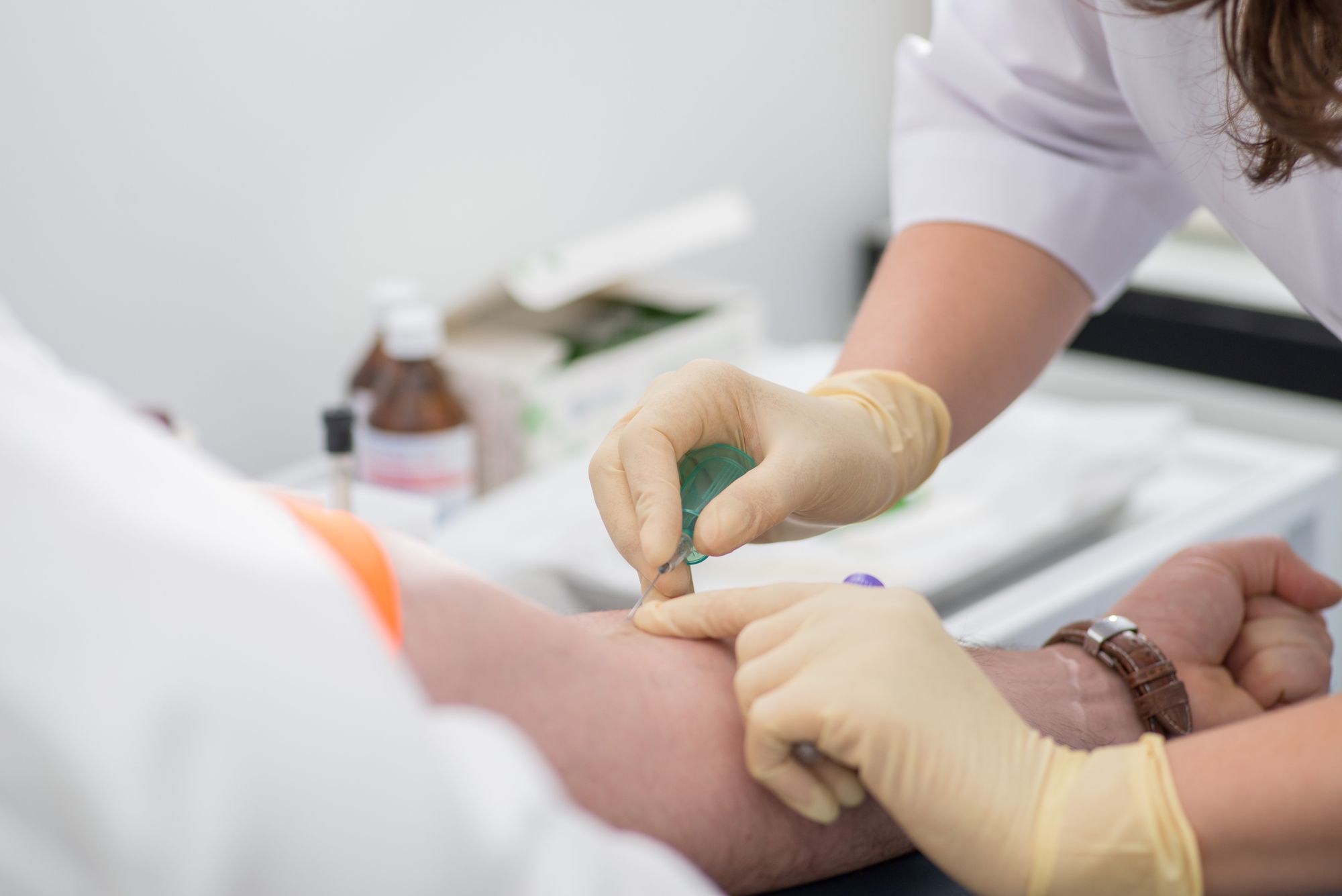 Анализы при выпадении волос